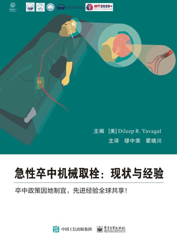 急性卒中机械取栓：现状与经验