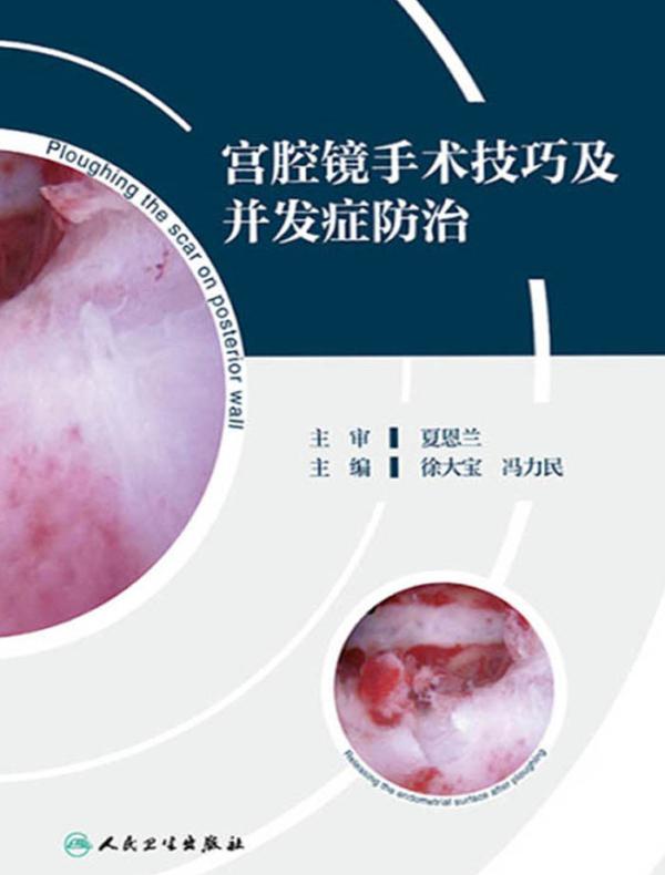 宫腔镜手术技巧及并发症防治