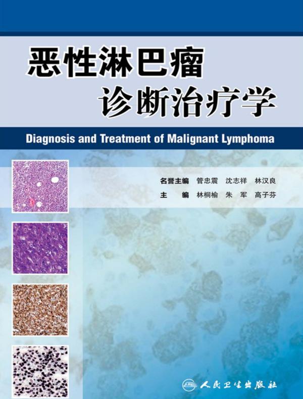 恶性淋巴瘤诊断治疗学