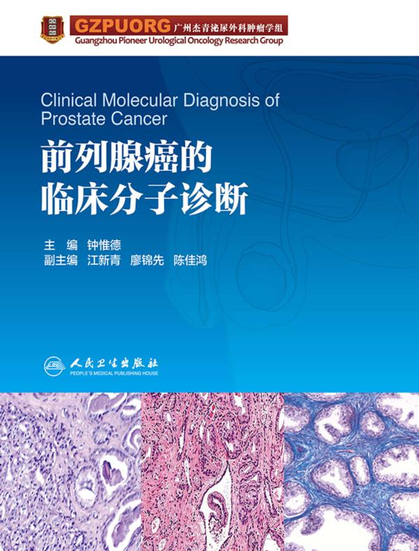 前列腺癌的临床分子诊断