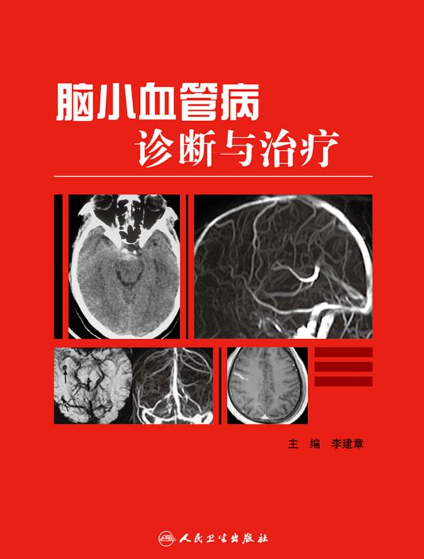 脑小血管病诊断与治疗