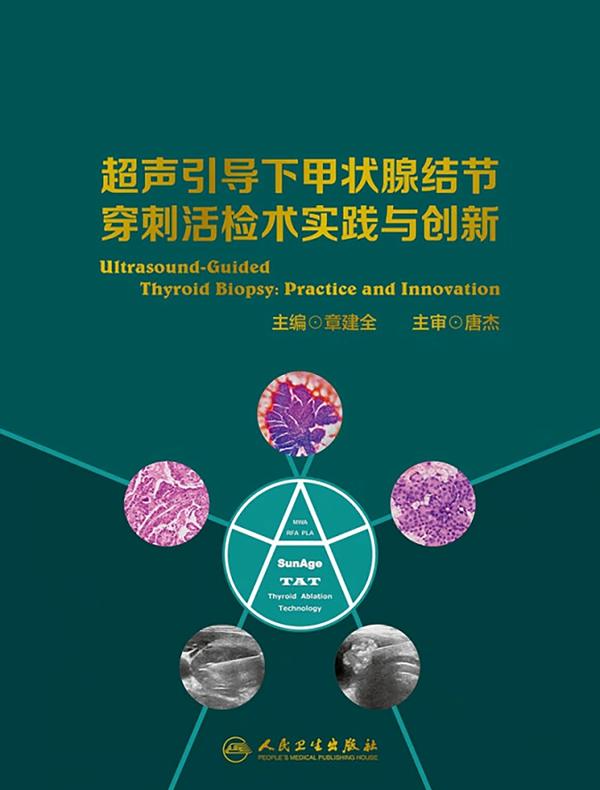 超声引导下甲状腺结节穿刺活检术实践与创新