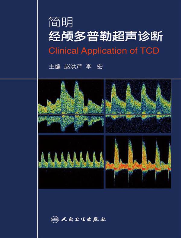 简明经颅多普勒超声诊断