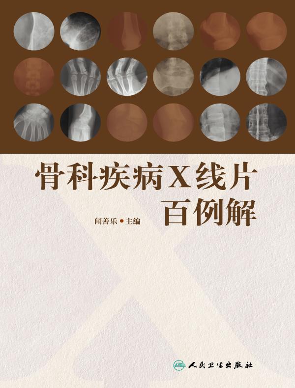 骨科疾病X线片百例解