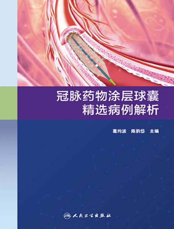 冠脉药物涂层球囊精选病例解析