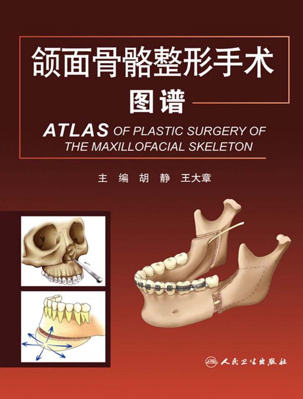 颌面骨骼整形手术图谱
