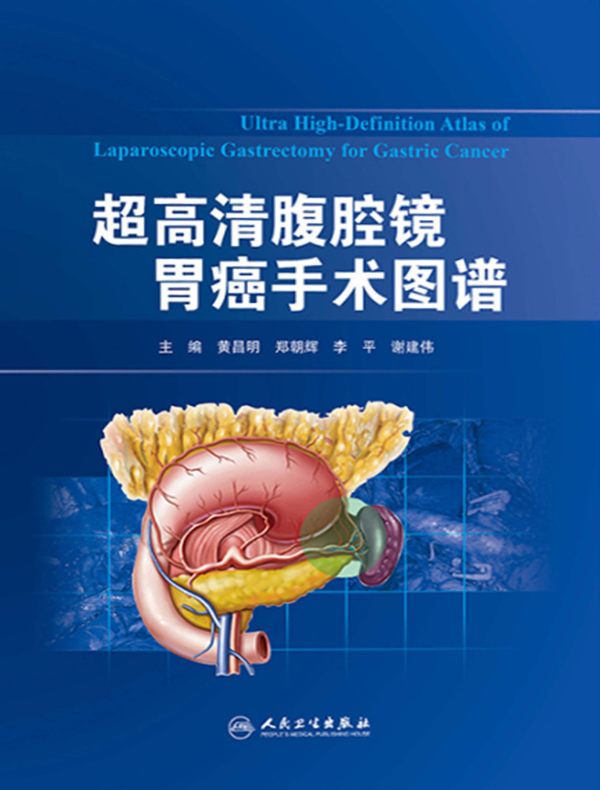 超高清腹腔镜胃癌手术图谱
