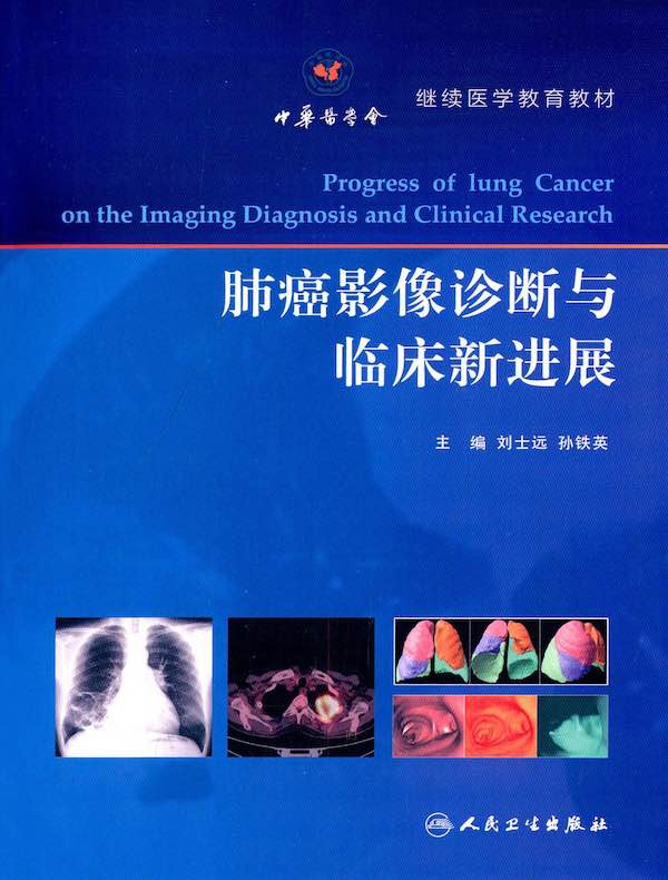 肺癌影像诊断与临床新进展
