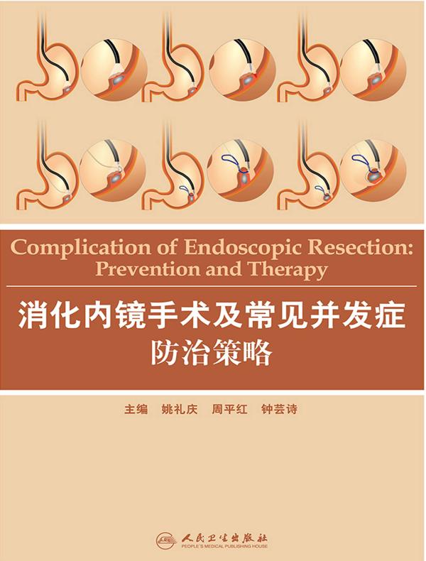 消化内镜手术及常见并发症防治策略