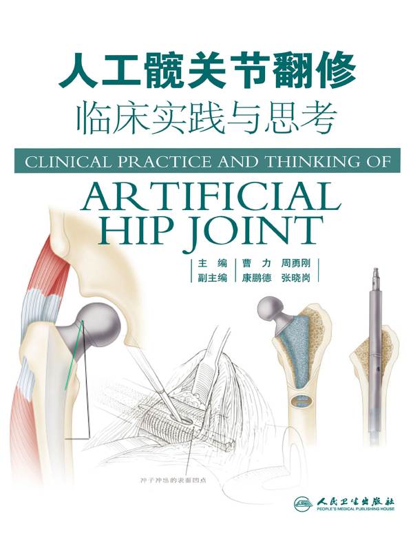 人工髋关节翻修临床实践与思考