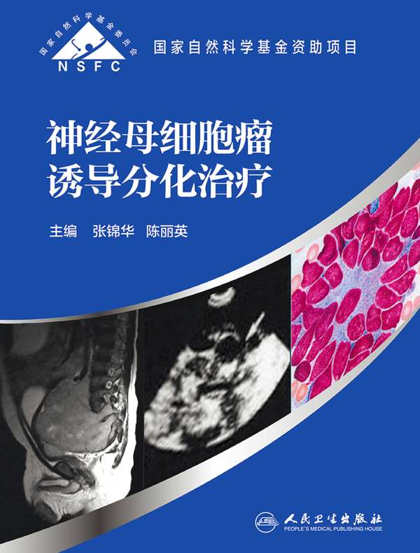 神经母细胞瘤诱导分化治疗