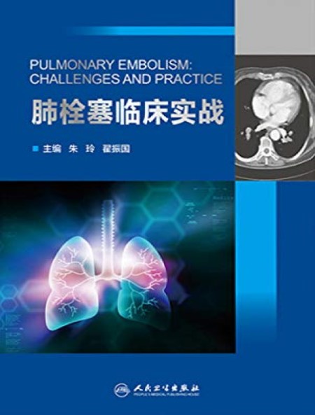 肺栓塞临床实战