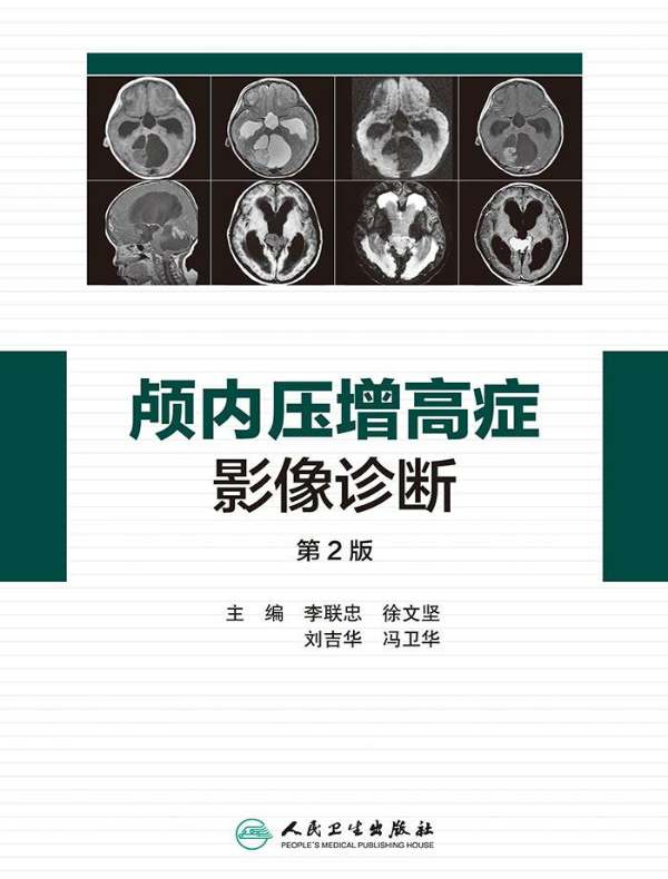 脊椎脊髄病学 第2版 [単行本] 岩崎 幹季 - 語学/参考書
