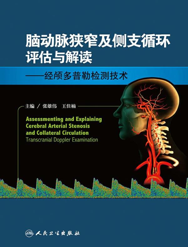 脑动脉狭窄及侧支循环评估与解读：经颅多普勒检测技术
