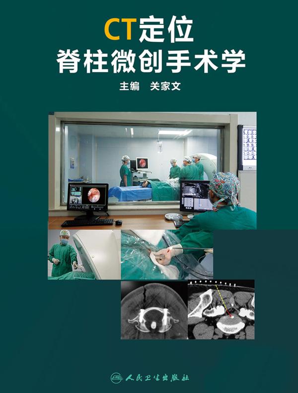 CT定位脊柱微创手术学
