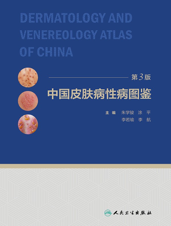 中国皮肤病性病图鉴（第3版）