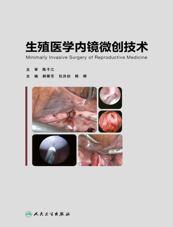 生殖医学内镜微创技术